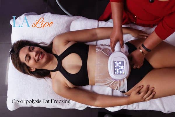 woman getting cryolipolysis Witney