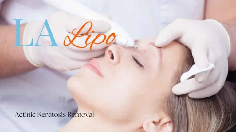 Woman receiving Actinic Keratosis Removal Treatment Witney