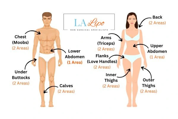LA LIPO Cryolipolysis Areas Witney
