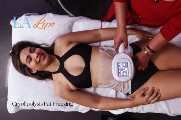 woman getting cryolipolysis Witney