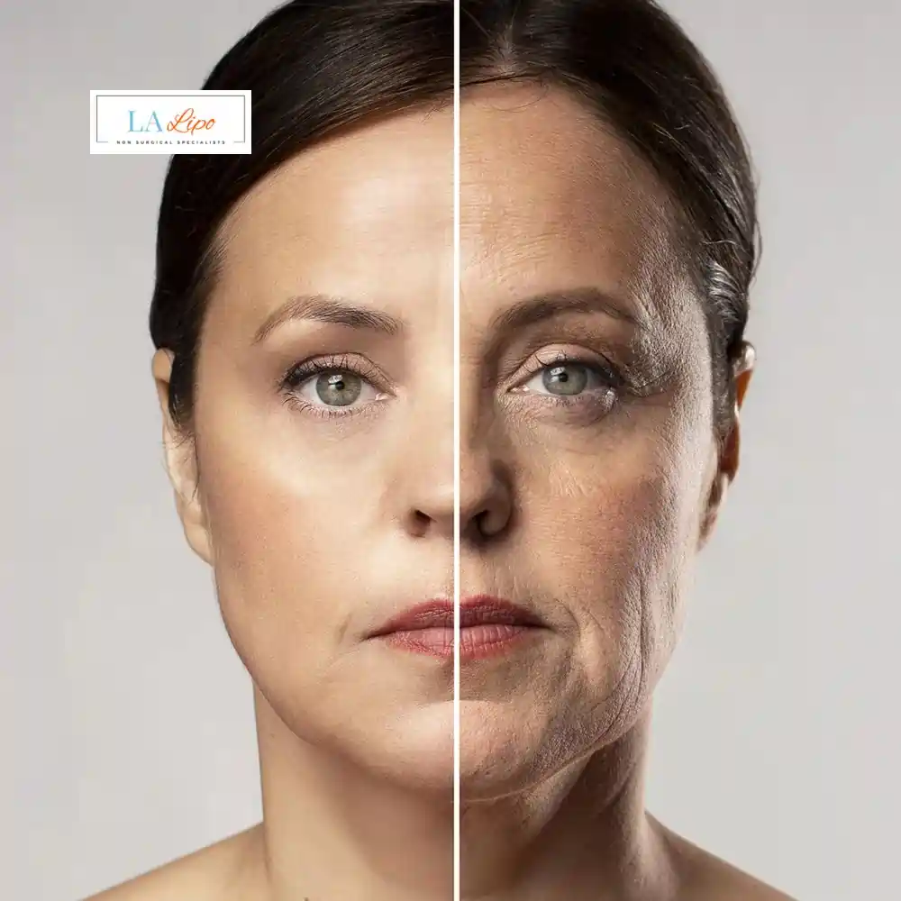 How Can You Tell If Non-Surgical Skin Tightening Is Right for You Witney?
