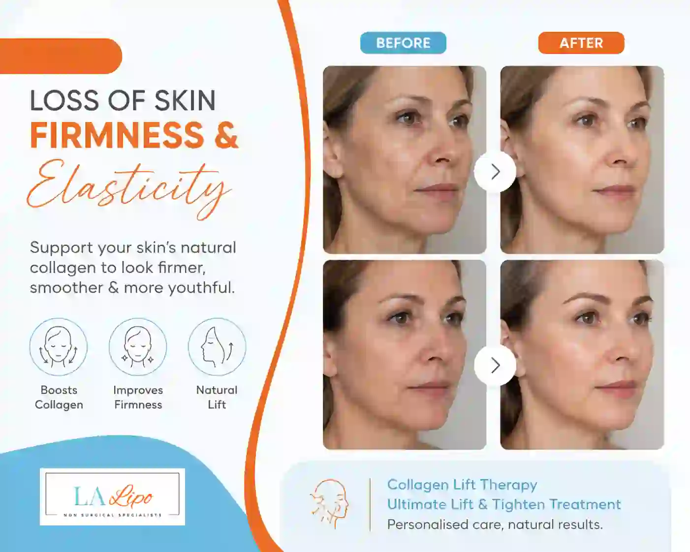 Sign #7: Loss of Skin Firmness and Elasticity Witney